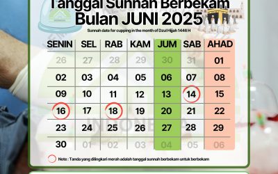 JADWALKAN BEKAM SUNNAH ANDA DI BULAN Dzulhijjah 1446H / Juni 2025M